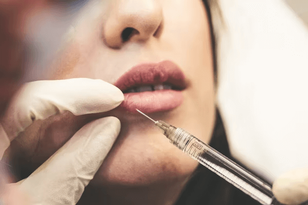 Woman receiving lip examination for BOTOX treatment