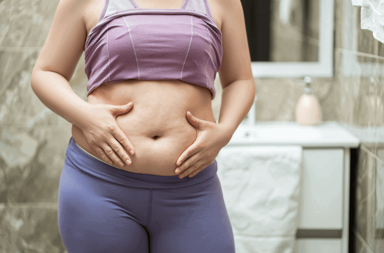 what moms should know about tummy tuck
