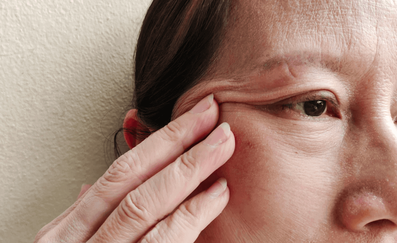 causes of sagging skin