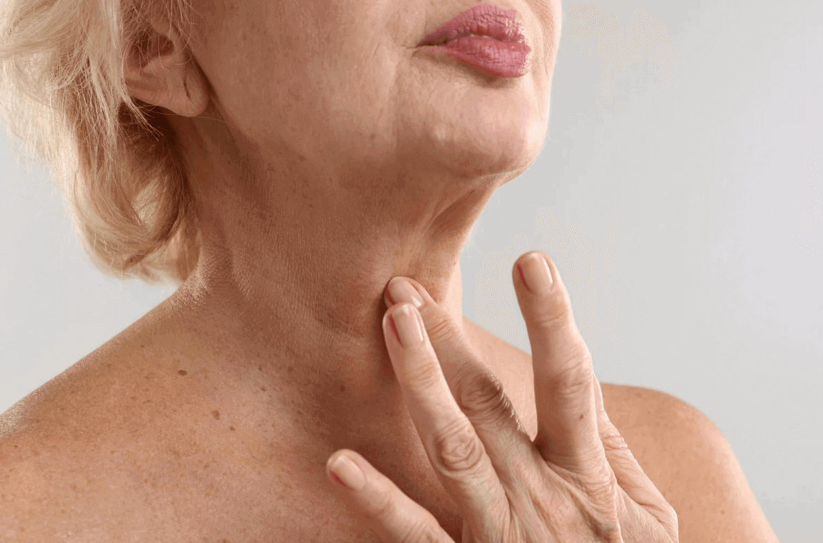 loose skin on the neck