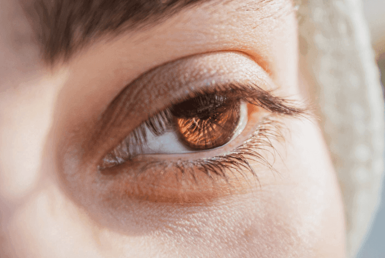 eyelid surgery
