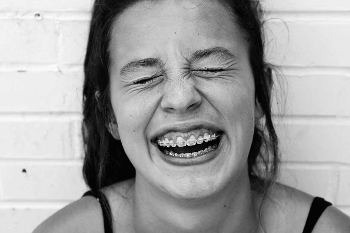 Woman with open mouth and missing tooth