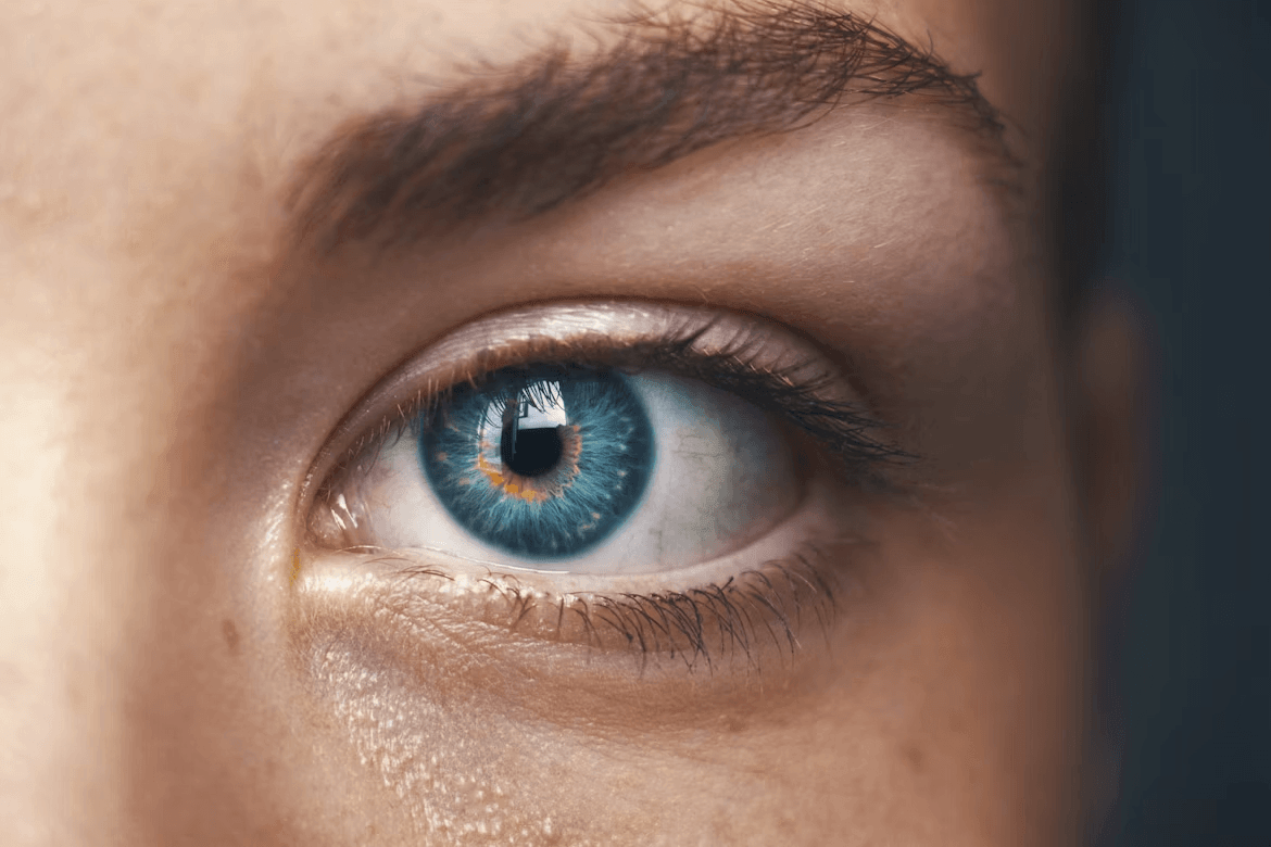 Close-up of a blue eye, possibly affected